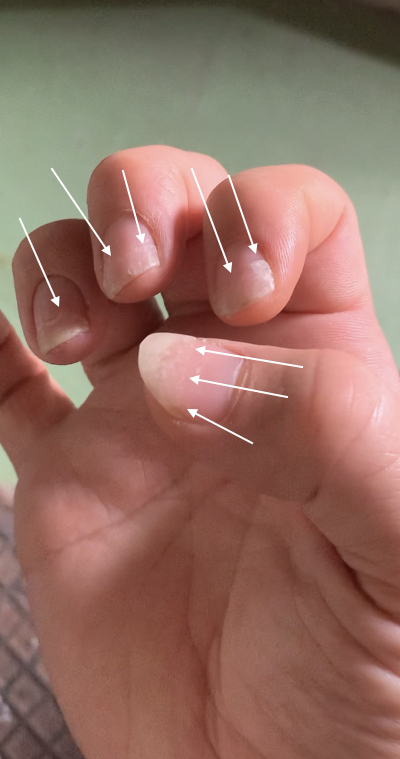 フラメンコギター奏者の爪について⑦ - フラメンコアーツ